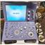 Aloka ProSound A6 Alpha 6 Ultrasound System