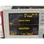Zoll M Series Biphasic Patient Monitor MFC ECG - Red w/ Paddles & Battery