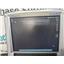 SonoSite M-Turbo Ultrasound System w/ HFL38x/13-6 MHz Probe