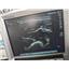 SonoSite M-Turbo Ultrasound System w/ HFL38x/13-6 MHz Probe