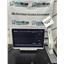 Mindray BeneVision N17 Patient Monitor