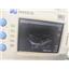 Sonosite 180 Plus Portable Ultrasound w/ L38/10-5 MHz Probe (NO POWER ADAPTER)
