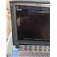 Sonosite Micormaxx Ultrasound Machine