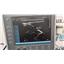 SonoSite S-Cath System w/ L25x - w/ Power Supply 2014