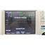 ZOLL R-Series ALS 3 Lead Patient Monitor NIBP, CO2, SPO2 - No Accessories