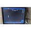 GE Logiq E Portable Ultrasound R9.1.2 w/ C1-5 RS Probe & Graphic Printer - 2017