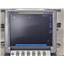 SonoSite M-Turbo Ultrasound System w/ Mini Dock & P21x/5-1 MHz Probe